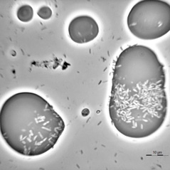 Lipophilic bacteria